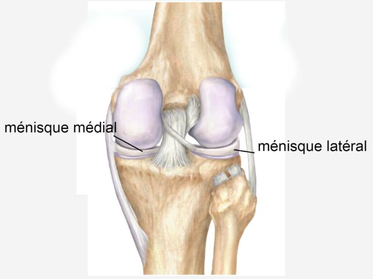 Le genou comporte un ménisque médial ou interne ou  et un ménisque latéral ou externe.