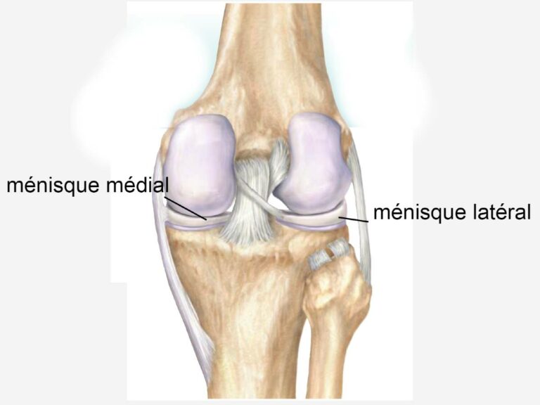 Lésions des ménisques | Urgence Sport Paris